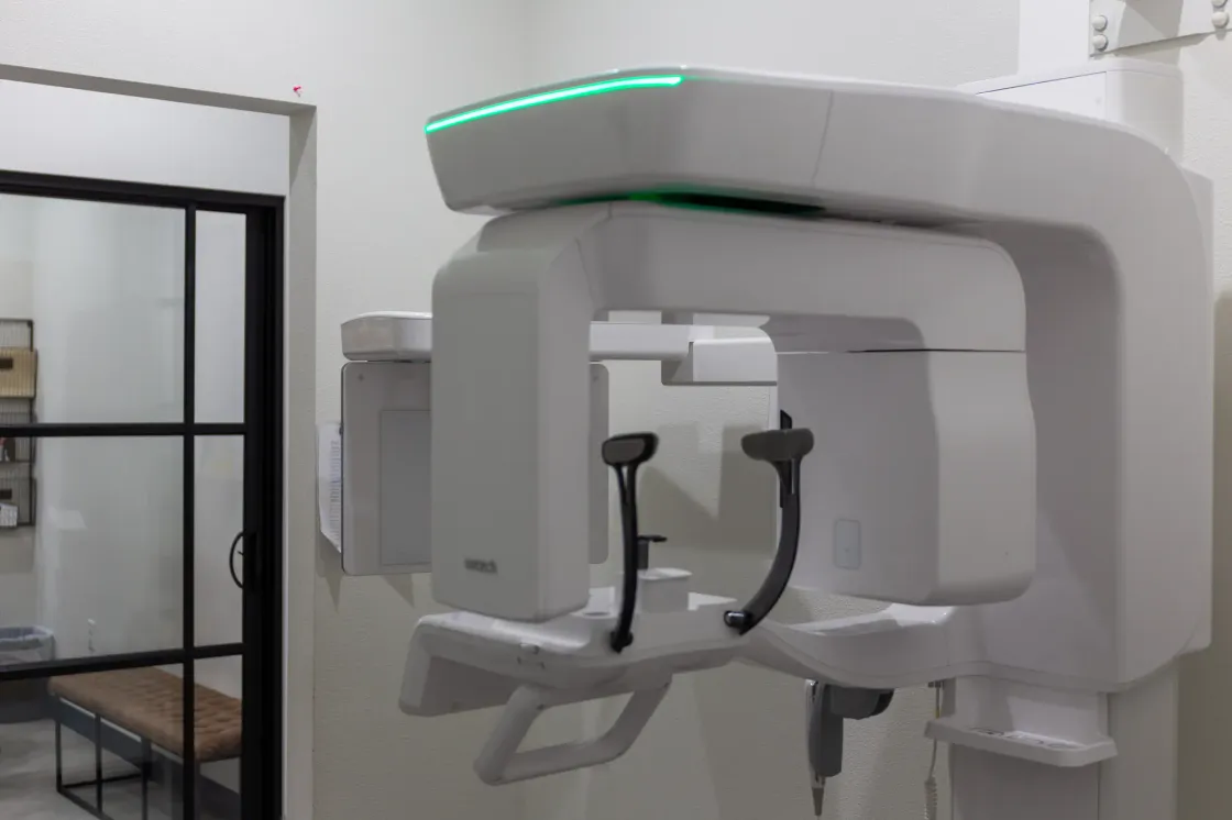 The 3D dental scanner at Arts Family Dentistry used for implant planning