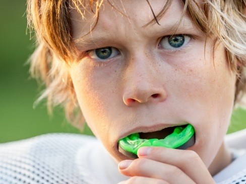 Teen athlete placing an athletic mouthguard
