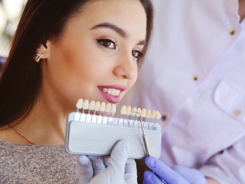 Woman's smile compared to porcelain veneer shade chart