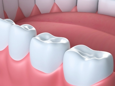 Animated smile with metal free dental crowns