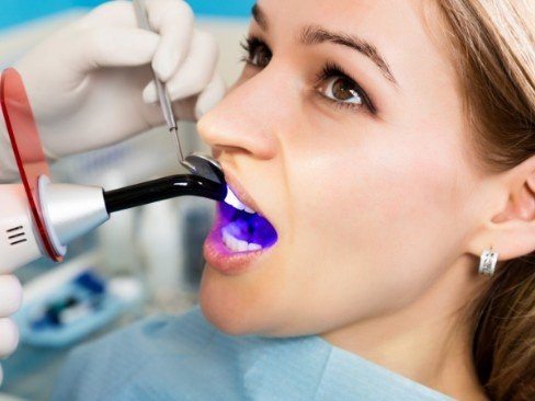 Woman receiving cosmetic dental bonding