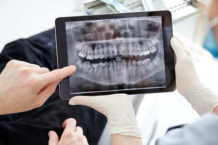 patient reviewing xray with patient