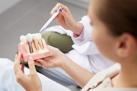 a patient holding a plastic model of a dental implant