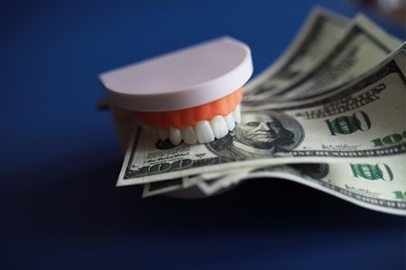 teeth holding money representing cost of dental implants in Dallas