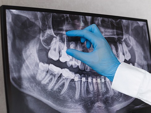 dentist looking at X-ray 