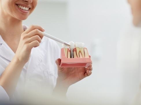 Dentist explaining the benefits of dental implants
