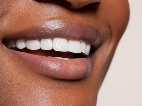 Closeup of patient with beautiful smile