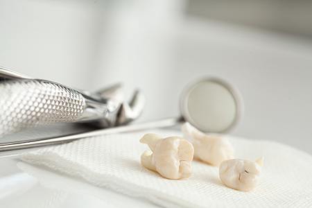 Multiple teeth sitting on cloth next to dental instruments