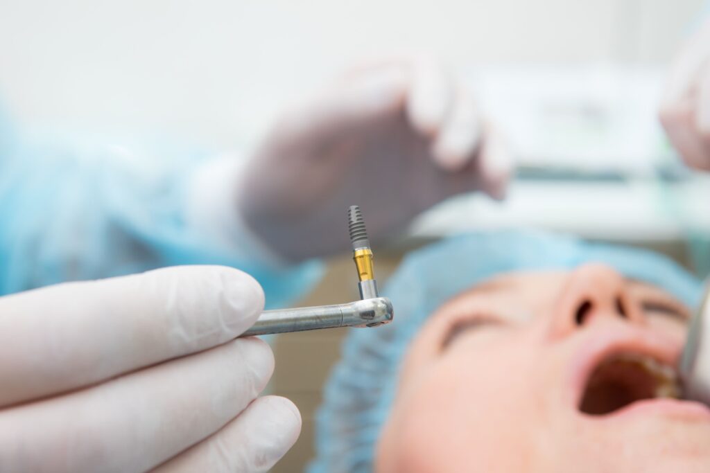 Closeup of implant before it's surgically placed in patient's mouth